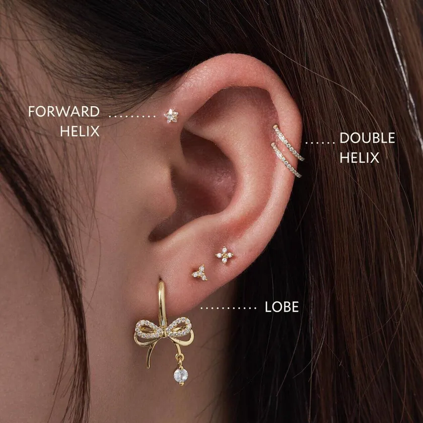 Vành tai cụp vs Vành tai mở — folded vs open ear anatomy