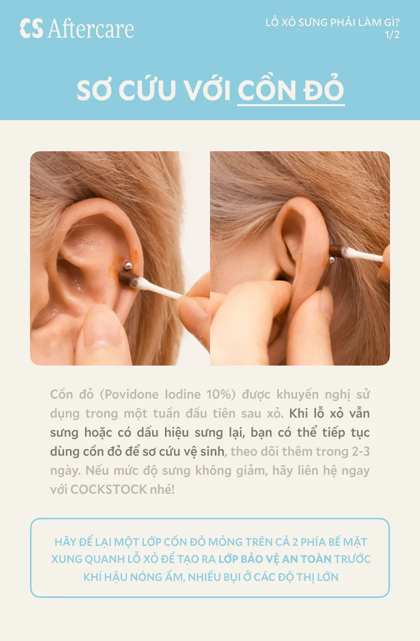 Sơ cứu với cồn đỏ Povidone Iodine