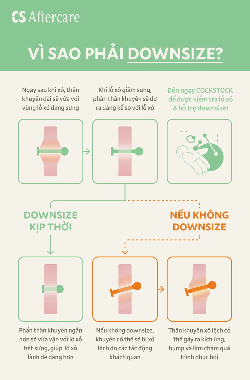 Vì sao phải Downsize — infographic quy trình