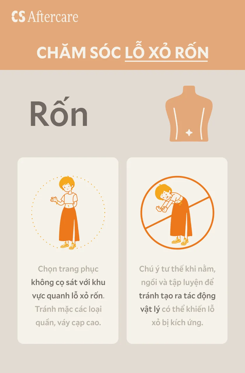 Chăm sóc lỗ xỏ rốn