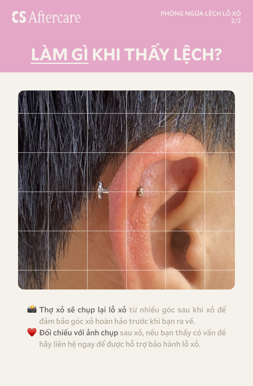 Làm gì khi thấy lệch lỗ xỏ