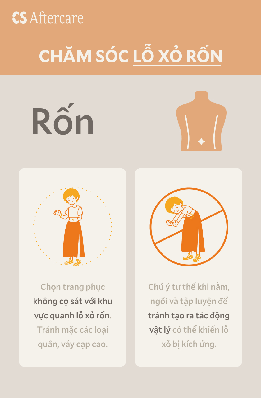 Chăm sóc lỗ xỏ rốn