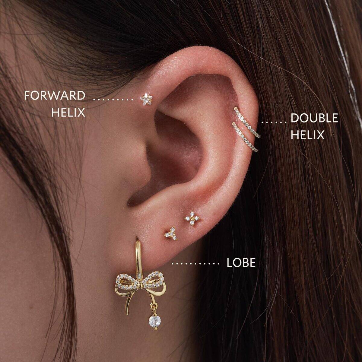 Vành tai cụp vs Vành tai mở — folded vs open ear anatomy