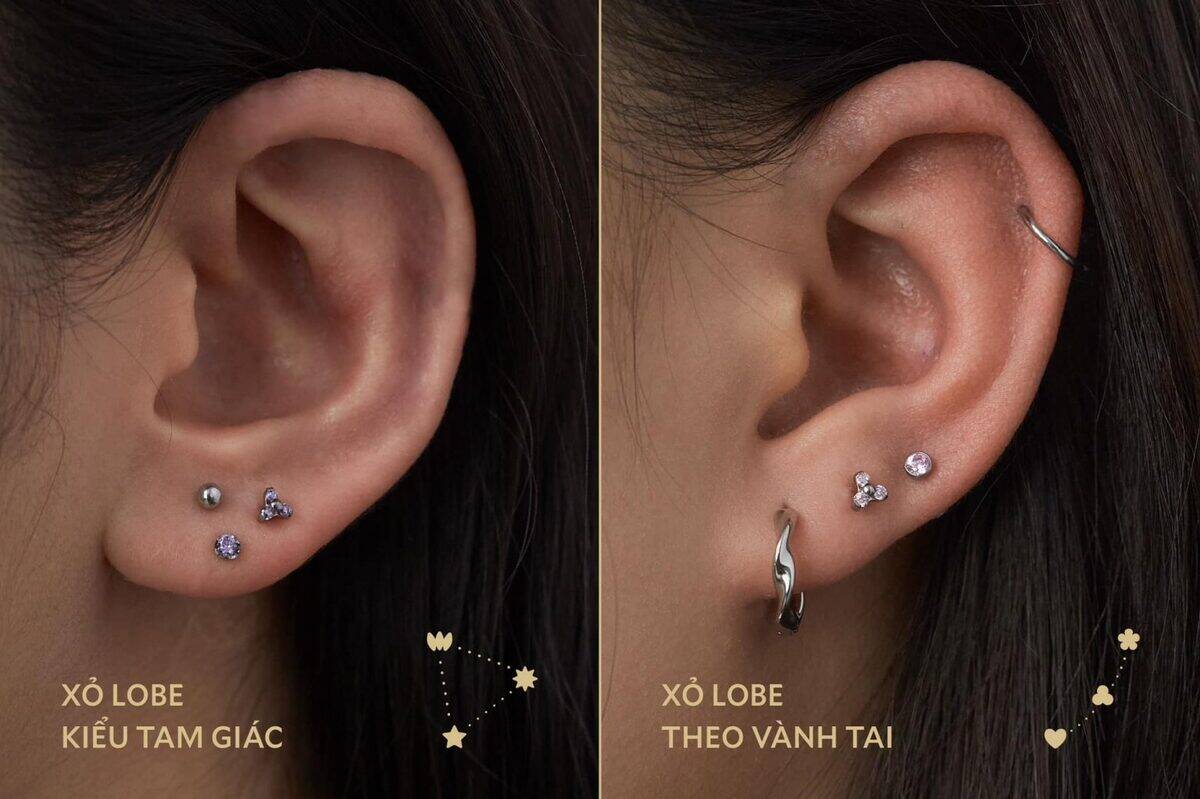 Lobe arrangements — Vertical, Triangle, Zigzag, Custom